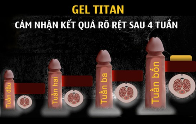 Gel bôi trơn Titan tăng kích thước chai 50ml an toàn hiệu quả